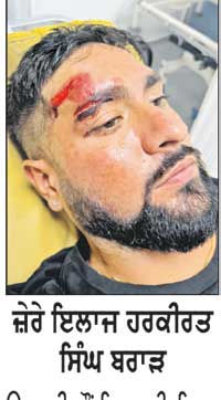 ਟਰਬੂਲੈਂਸ ਦਾ ਸਾਹਮਣਾ ਕਰਨ ਵਾਲੀ ਏਅਰ ਇੰਡੀਆ ਦੇ ਜਹਾਜ਼ ’ਚ ਸਵਾਰ ਬਰਤਾਨਵੀ ਨਾਗਰਿਕ ਦੇ ਲੱਗੀਆਂ ਸੱਟਾਂ