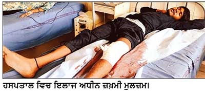ਪੁਲਿਸ ਨੂੰ ਲੋੜੀਂਦਾ ਮੁਲਜ਼ਮ ਮੁਕਾਬਲੇ ਦੌਰਾਨ ਗੋਲੀਆਂ ਲੱਗਣ ਨਾਲ ਜ਼ਖ਼ਮੀ